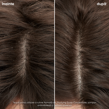 Încarcă imaginea în Galerie, Biolage Scalp Sync Purifying Scalp Concentrate - Tratament Pre-Sampon 200ml