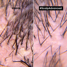 Încarcă imaginea în Galerie, L'Oreal Professionnel SE Expert Scalp Advanced - Sampon Pentru Scalp Sensibil - Beauty Lounge