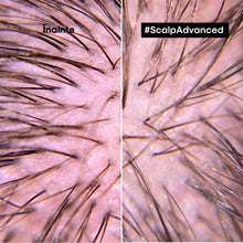 Încarcă imaginea în Galerie, L’Oreal Professionnel SE Scalp Advanced - Tratament Profesional Calmant pentru Scalp Sensibil 200ml