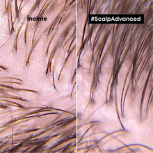Încarcă imaginea în Galerie, L'Oreal Professionnel SE Scalp Advanced - Sampon Profesional pentru Scalp Gras 300ml