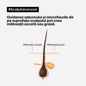 L'Oreal Professionnel SE Scalp Advanced Anti-Dandruff - Sampon Anti-matreata 300ml
