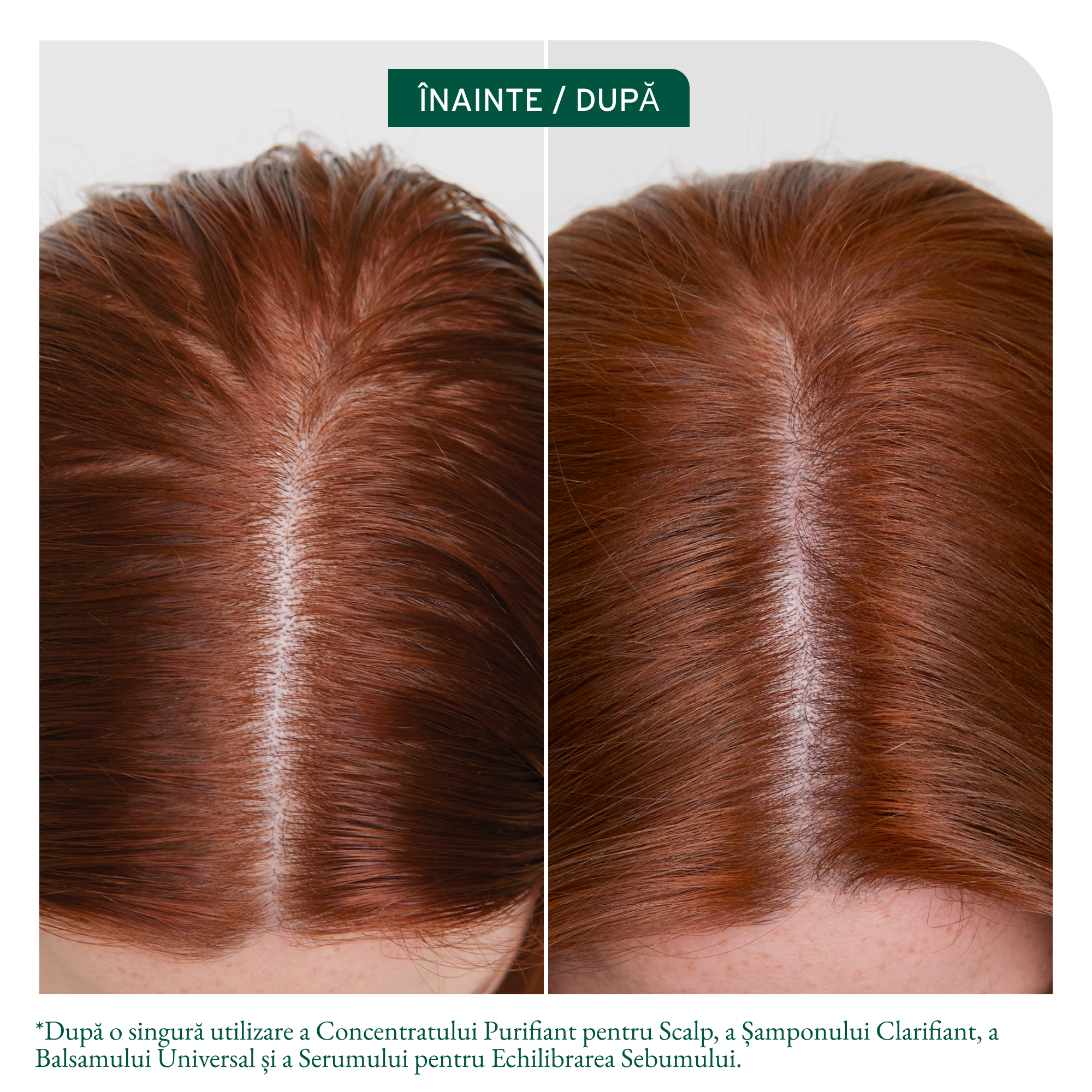 Biolage Scalp Sync Clarifying Shampoo - Sampon Anti-Matreata 400ml