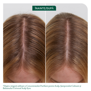 Biolage Scalp Sync Calming Shampoo - Sampon Calmant 400ml