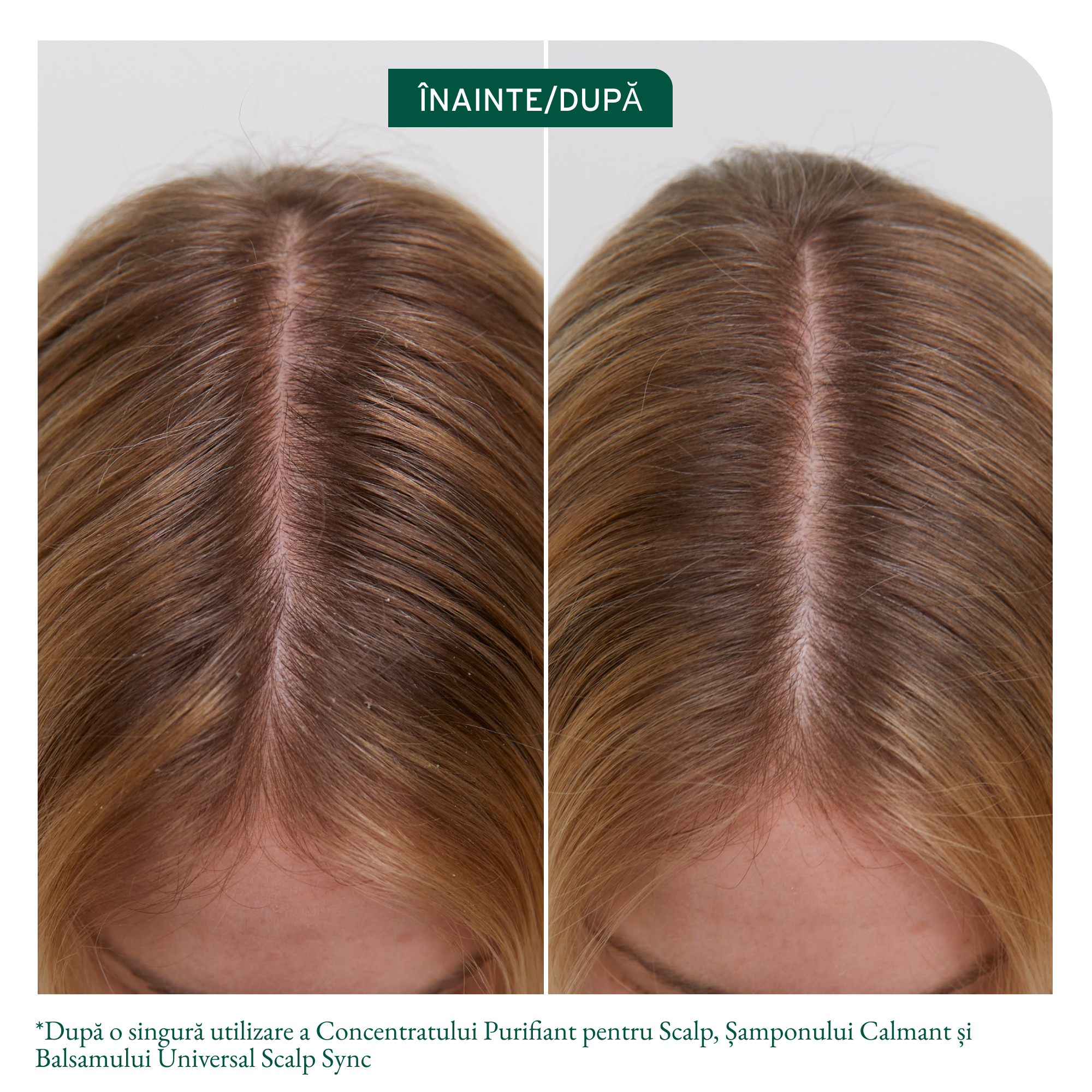 Biolage Scalp Sync Conditioner 236ml - Balsam Pentru Toate Tipurile de Par