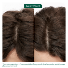 Încarcă imaginea în Galerie, Matrix Biolage Scalp Anti-Dandruff Shampoo - Sampon Anti-matreata 400ml
