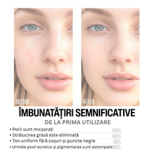 Încarcă imaginea în Galerie, 7DAYS Set Cadou My Beauty Week Mattifying Paradise - Pentru Matifiere
