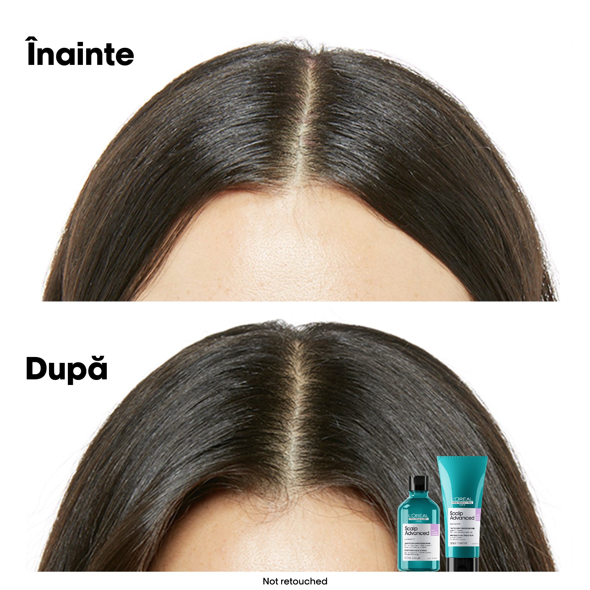L'Oreal Professionnel SE Scalp Advanced 500ml - Rezerva Sampon pentru Scalp Sensibil