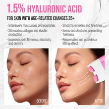 Încarcă imaginea în Galerie, 7DAYS Concentrat Lifting Facial V-Shaping Hialuronic 40ml - Concentrat Anti-rid
