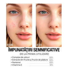 Încarcă imaginea în Galerie, 7Days AHA 5% + BHA 2% Facial Peeling Serum 20ml - Ser Exfoliant Pentru Fata
