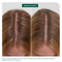 Încarcă imaginea în Galerie, Matrix Biolage Scalp Sync Purifying Scalp Concentrate - Tratament Pre-Sampon 200ml
