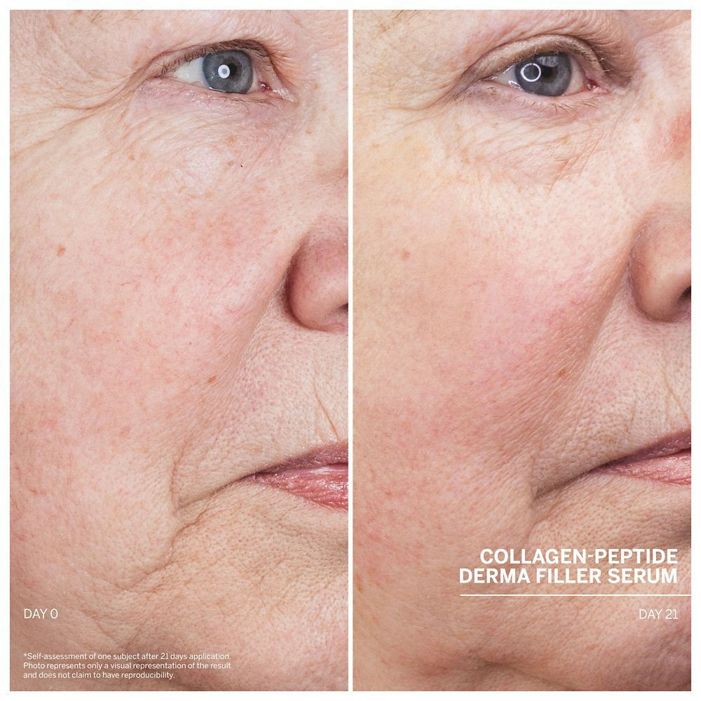 Babor Derma Filler Serum 30ml - Ser Cu Peptide De Colagen Pentru Riduri si Fermitate