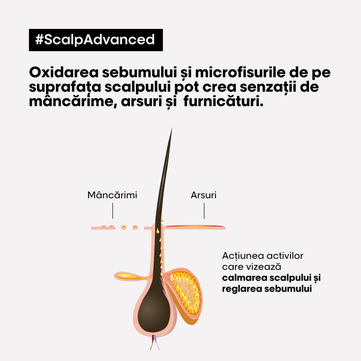 L'Oreal Professionnel SE Scalp Advanced Anti-Discomfort 300ml - Sampon Dermo-Regulator Niacinamide