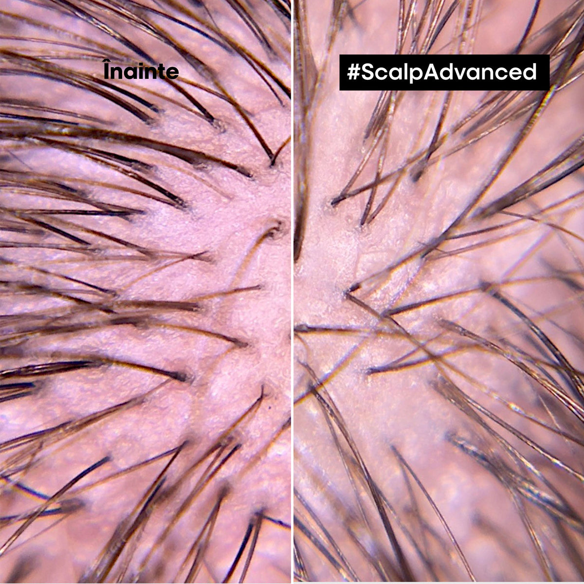 L'Oreal Professionnel SE Scalp Advanced Anti-Discomfort 300ml - Sampon Dermo-Regulator Niacinamide