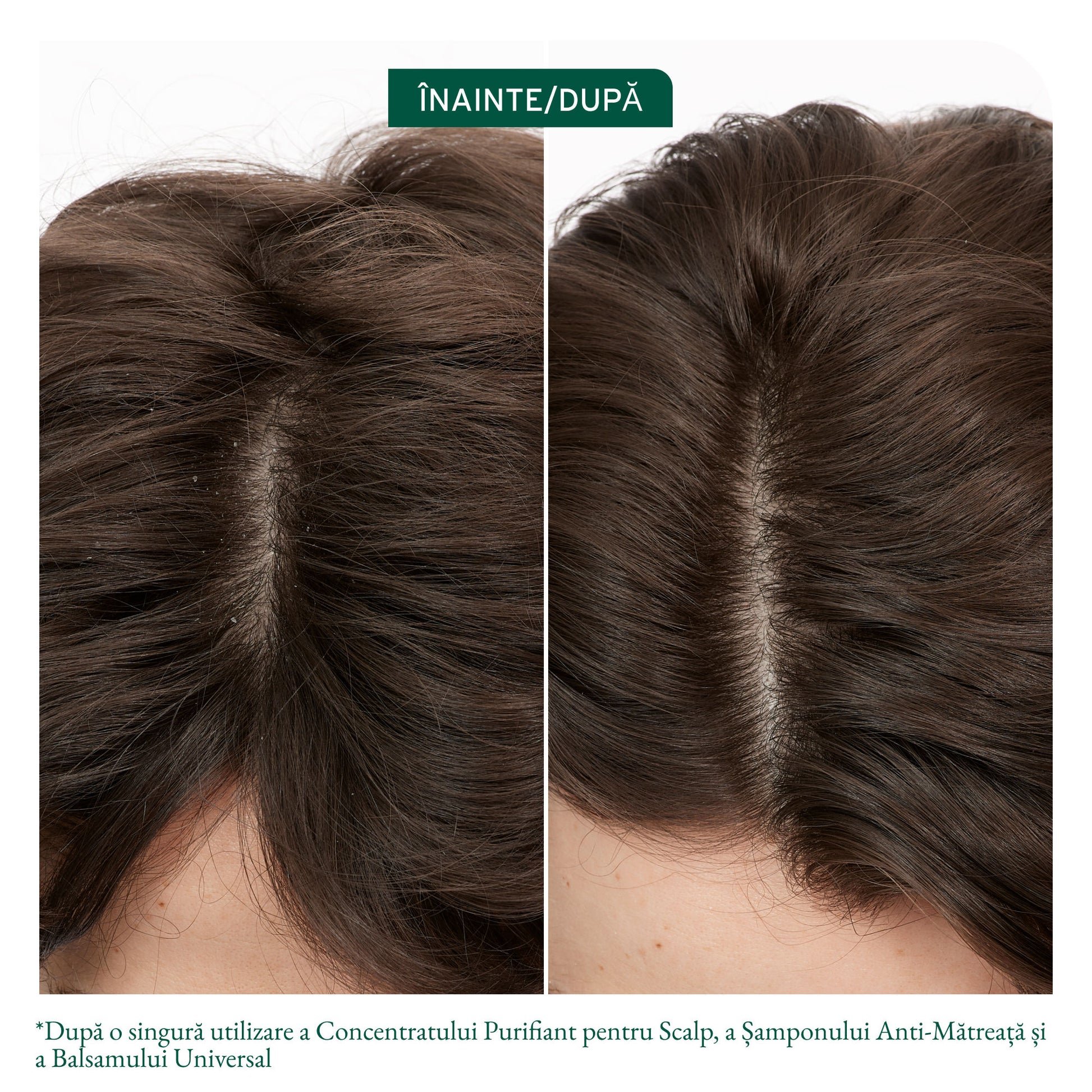 Matrix Biolage Scalp Sync Sampon Antimatreata 400ml - Pentru Scalp Predispus la Matreata