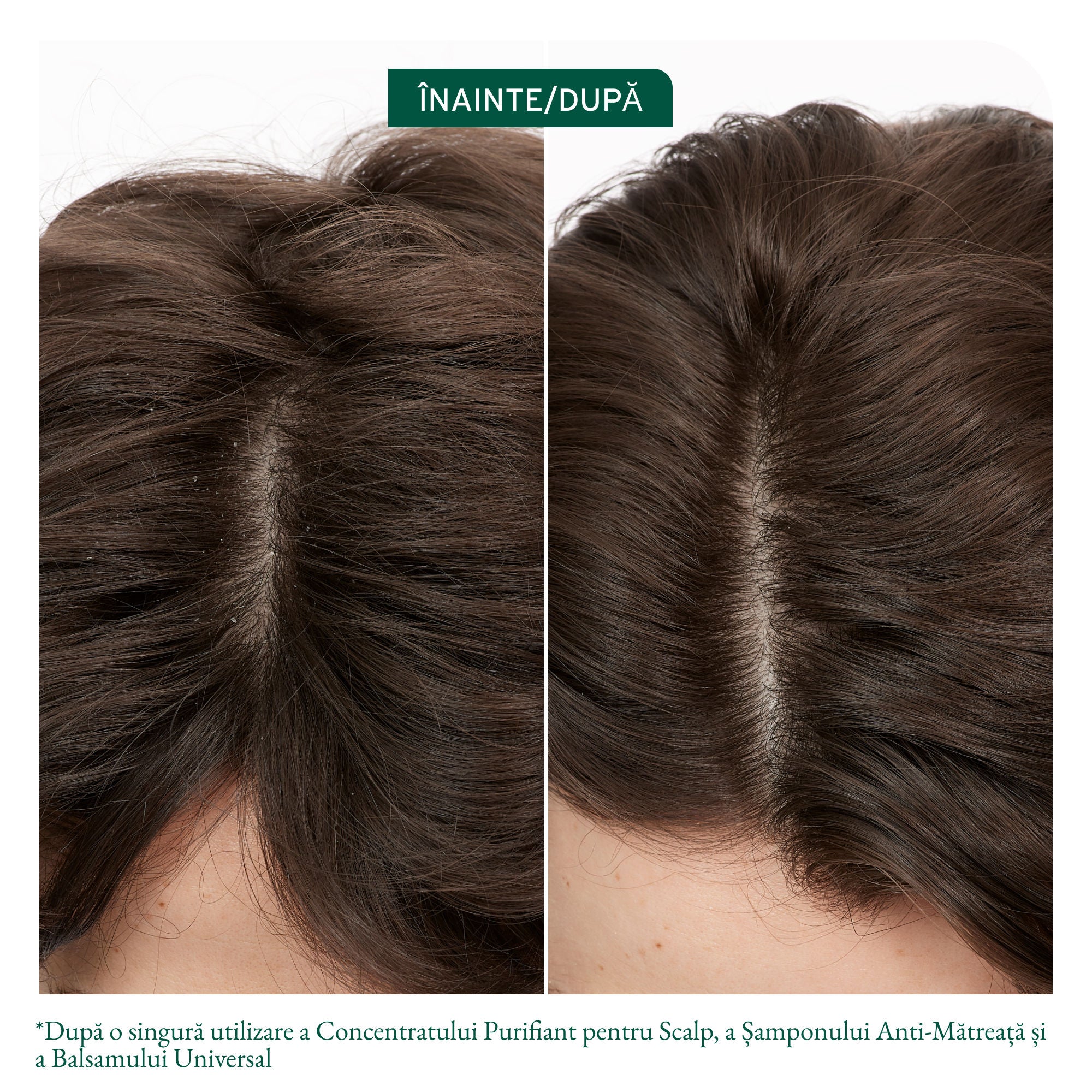 Matrix Biolage Scalp Sync Sampon Antimatreata 400ml - Pentru Scalp Predispus la Matreata