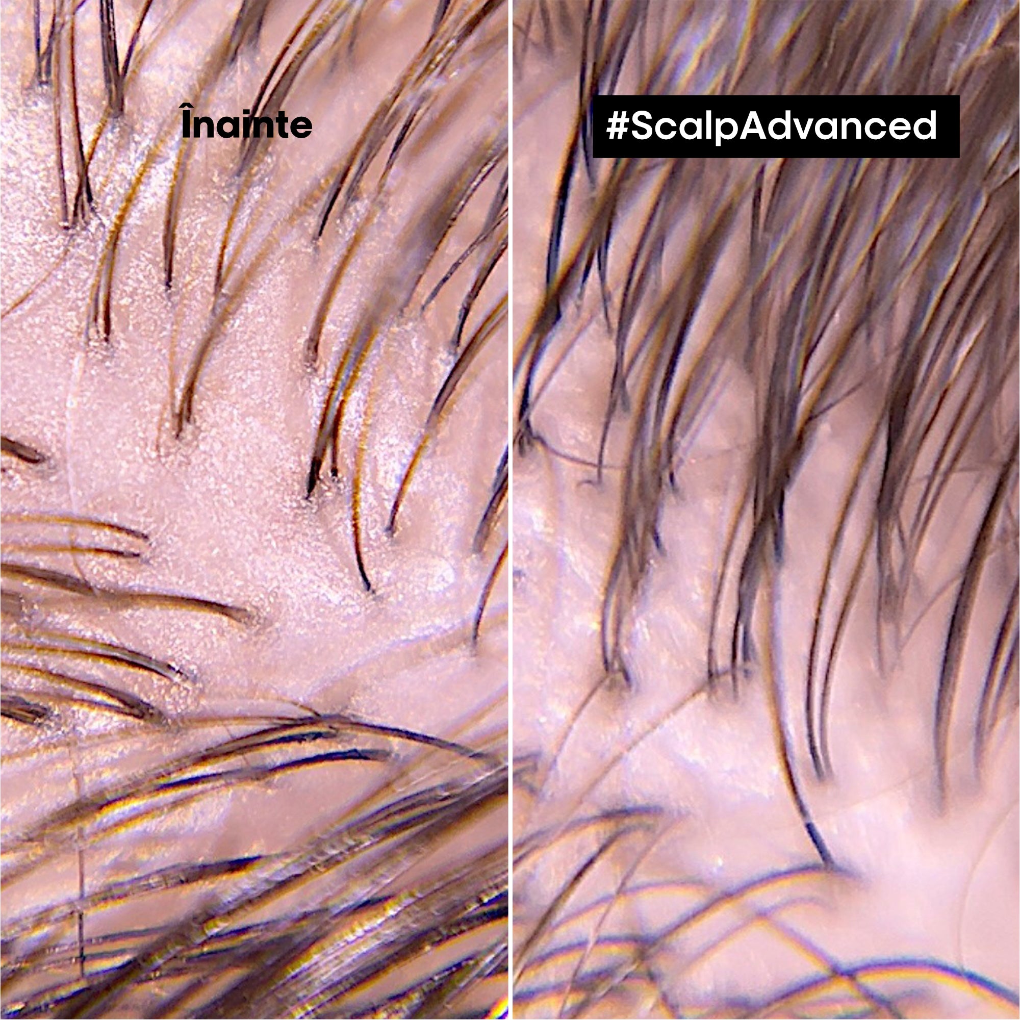 L’Oreal Professionnel SE Scalp Advanced 2in1 Sampon si Masca 250ml cu Argila Purifianta